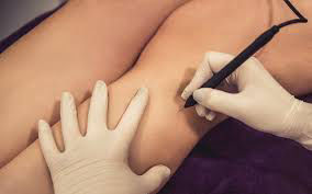 ADANA İĞNELİ EPİLASYON MERKEZİ